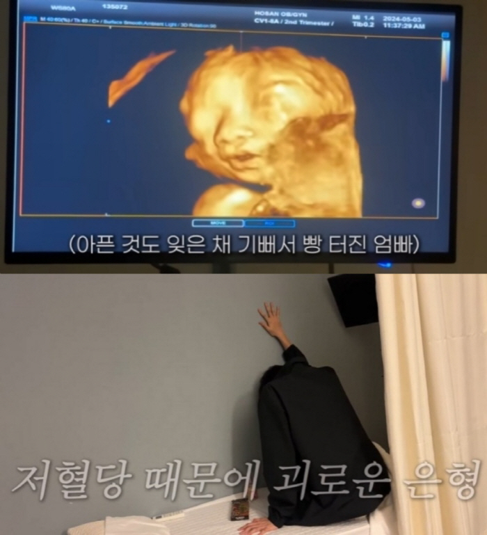 이은형♥강재준, 저혈당 쇼크에도 '깡총이' 초음파 사진에 '함박 웃음' ('기유TV')