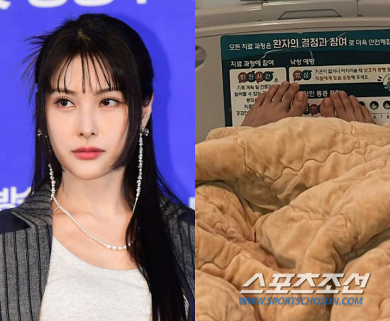 '카라 컴백 앞둔' 박규리, 광대·안와골절 수술…"기도해줘요"